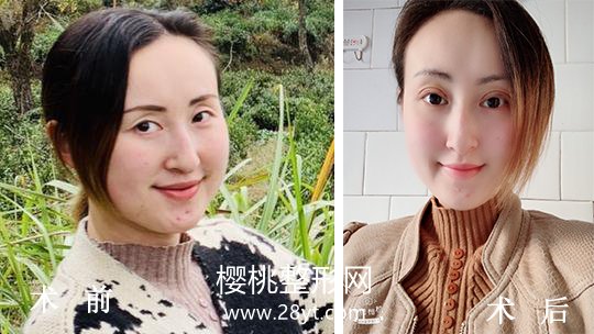 合肥华美整形外科医院正规吗?做整形价格贵不贵?