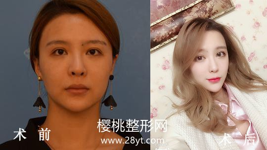 合肥华美整形外科医院正规吗?做整形价格贵不贵?