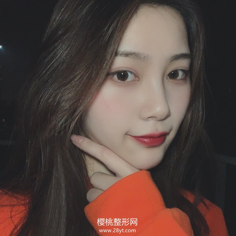 福州爱美尔张胜利隆鼻技术怎么样?附真人案例+最新价格表一览