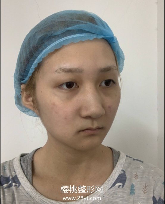 北京杜大夫医疗美容医院怎么样? 医院简介 附双眼皮案例