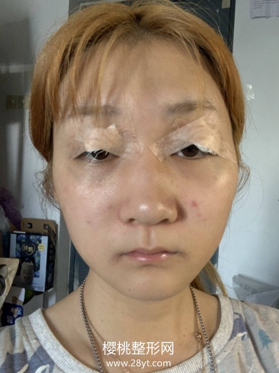 北京杜大夫医疗美容医院怎么样? 医院简介 附双眼皮案例