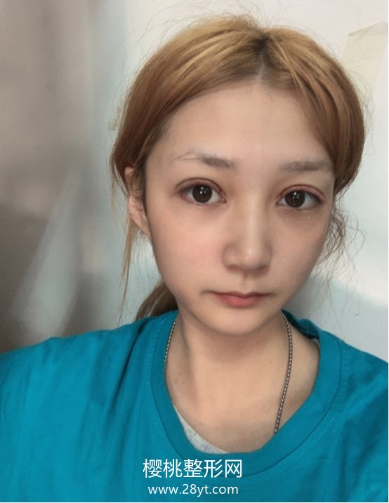 北京杜大夫医疗美容医院怎么样? 医院简介 附双眼皮案例