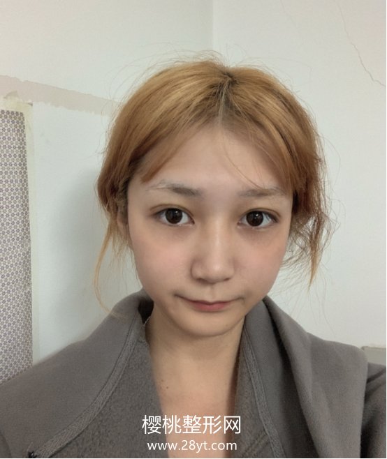 北京杜大夫医疗美容医院怎么样? 医院简介 附双眼皮案例