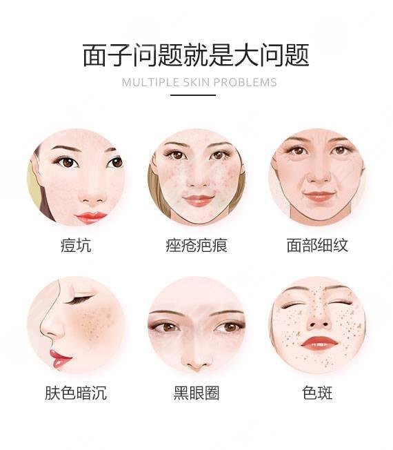 济宁附属医院整形科祛痘介绍