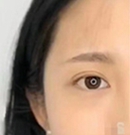 沈阳和平元辰纹眉技术怎么样?2个月后的效果超出我的想象