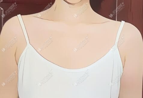 做傲诺拉星熠270cc中凸隆胸术前照片 做傲诺拉星熠270cc中凸隆胸术前照片