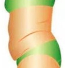 腰腹吸脂3000cc会瘦很多吗?术后腰围瘦了12厘米,成效挺明显