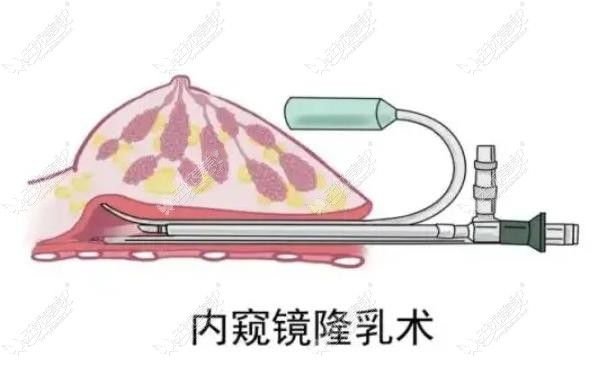 唐新辉做假体隆胸价格www.51aimei.com 唐新辉做假体隆胸价格www.51aimei.com