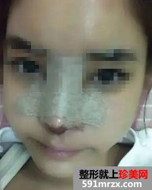 �������¡�ǻָ����� ����Ư����������