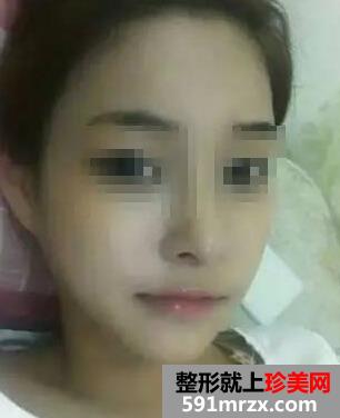 �������¡�ǻָ����� ����Ư����������