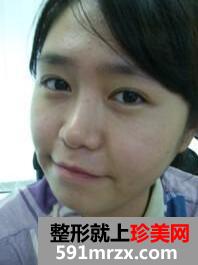 СѼĻɱ ߷˫Ƥ+轺¡