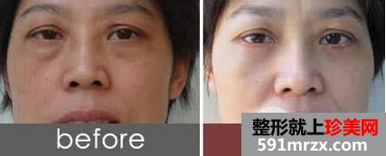 �����۴���ûָ�ͼƬ �����۴�������Ҫ����Ǯ