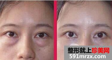 �����۴���ûָ�ͼƬ �����۴�������Ҫ����Ǯ