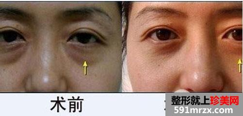 �����۴���ûָ�ͼƬ �����۴�������Ҫ����Ǯ