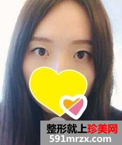 ˫��Ƥ����1