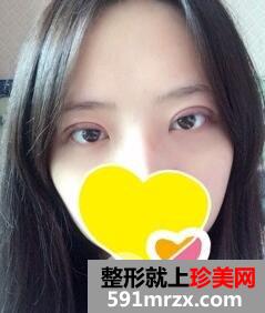 ˫��Ƥ����2