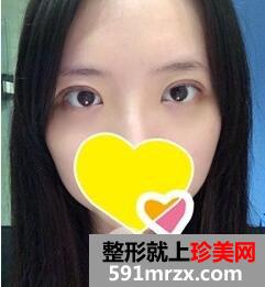 ˫��Ƥ����3