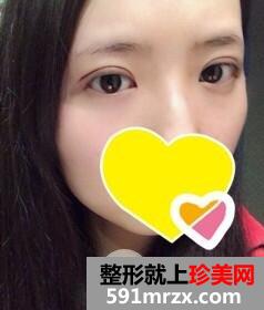 ˫��Ƥ����5