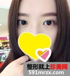 ˫��Ƥ����7