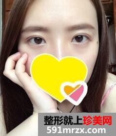 ˫��Ƥ����8