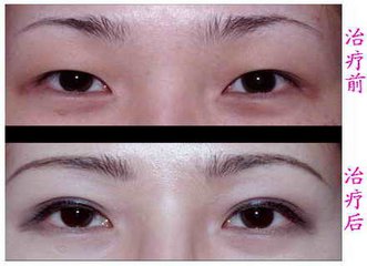 ȫ�мӿ��۽�Ҫ����Ǯ