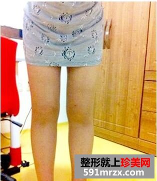 Ϊ�ݴ������˴�����֬ ��������������֬����