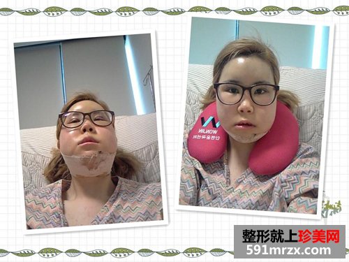 ��������+���ͽ�����ǰ��Ч���Ա�ͼ�ͻָ�����