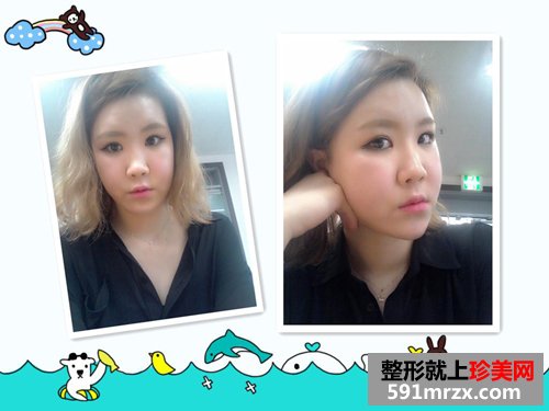 ��������+���ͽ�����ǰ��Ч���Ա�ͼ�ͻָ�����