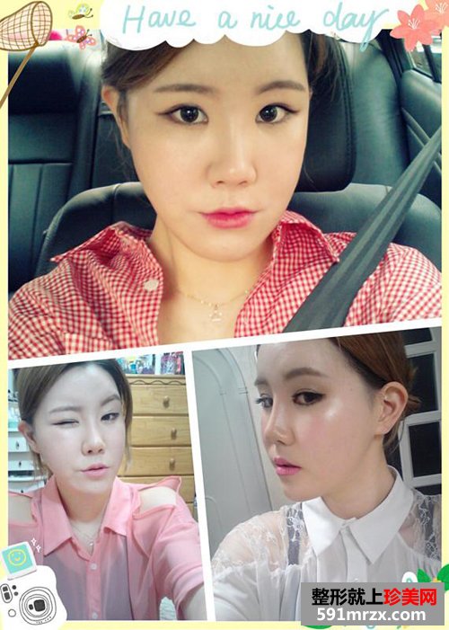 ��������+���ͽ�����ǰ��Ч���Ա�ͼ�ͻָ�����