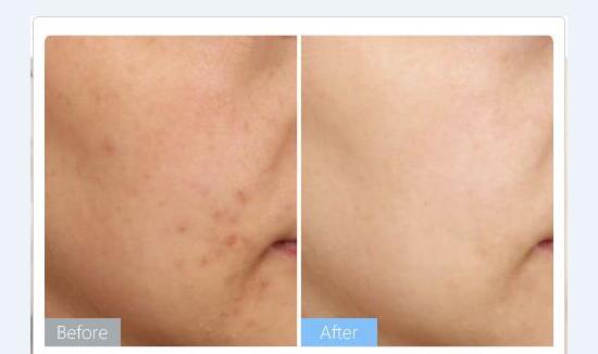 ��Ů��˽�ܴ�������(˽����������ô����)