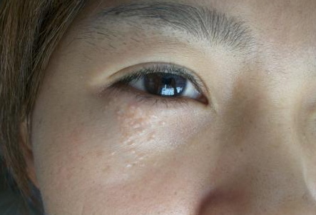 ǭ����֬����Ǯ(��֬��ż۸�)