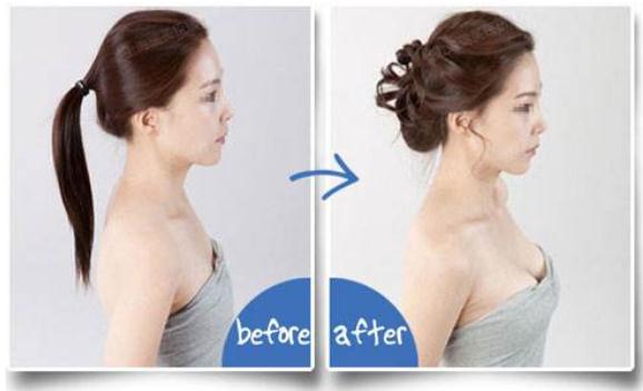 假体隆胸10个人有9个做完后悔?后遗症这么恐怖吗?