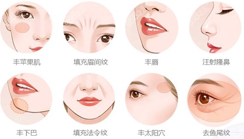 脂肪填充不同部位 脂肪填充不同部位