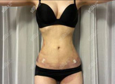 20210519578917.png 2.png