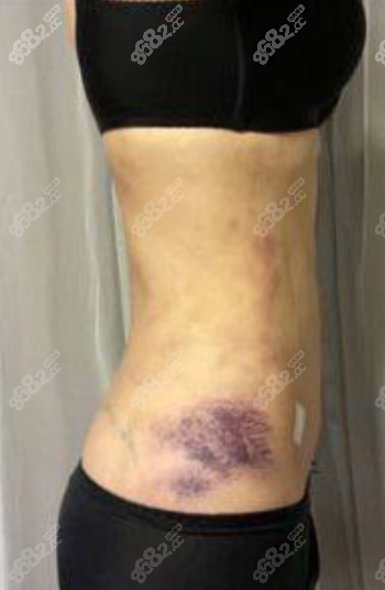 20210519992325.png 2-1.png