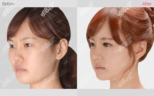 韩国必当归医院 韩国必当归医院