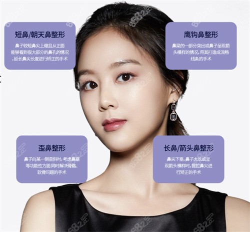 韩国梦想整形外科医院 韩国梦想整形外科医院