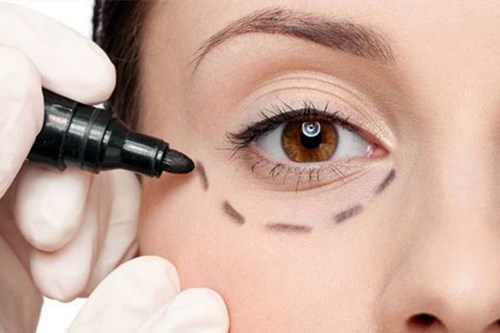 去眼袋手术多少钱2.jpg 去眼袋手术多少钱2.jpg