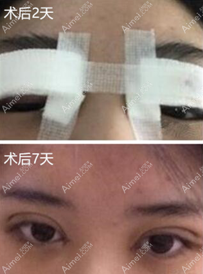 一周左右那会儿 一周左右那会儿