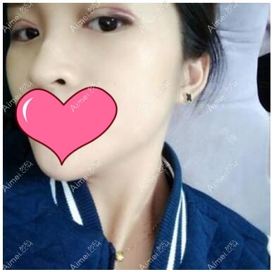 术后5天 术后5天