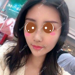 做肋软骨鼻综合术后7天拆线 做肋软骨鼻综合术后7天拆线