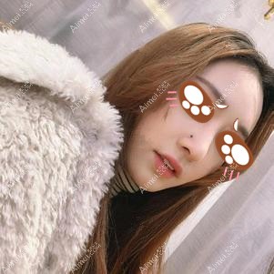 在党宁医生做耳软骨隆鼻术后2个月恢复 在党宁医生做耳软骨隆鼻术后2个月恢复