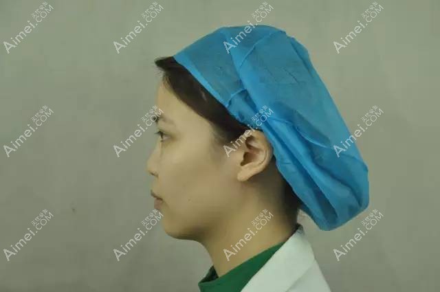 面诊时侧面鼻子效果 面诊时侧面鼻子效果