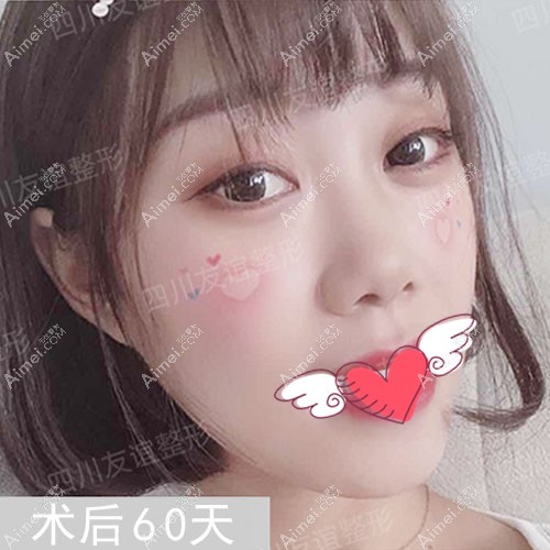 不知成都磨骨哪家医院好,参考友谊医院案例 不知成都磨骨哪家医院好,参考友谊医院案例