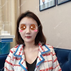 找郑荃医生做脂肪修复术后45天 找郑荃医生做脂肪修复术后45天