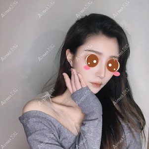 在重庆铂生做鼻综合术后2个月 在重庆铂生做鼻综合术后2个月