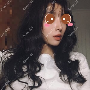 在重庆铂生做鼻综合术后22天 在重庆铂生做鼻综合术后22天