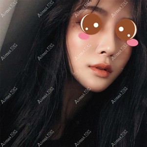 在重庆铂生做鼻综合术后1个月 在重庆铂生做鼻综合术后1个月