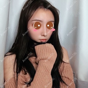 在重庆铂生做鼻综合术后15天 在重庆铂生做鼻综合术后15天