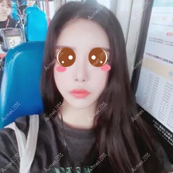 在武汉五洲莱美做脂肪填充术后45天 在武汉五洲莱美做脂肪填充术后45天